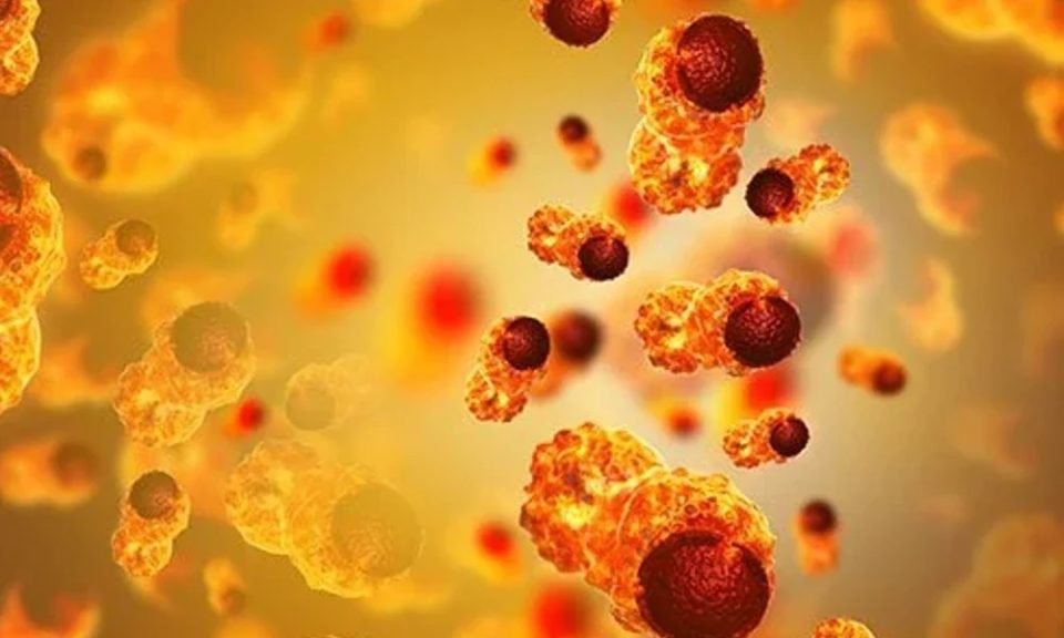 Advantages, Cancer Prevention, And More Of Keto For Cancer