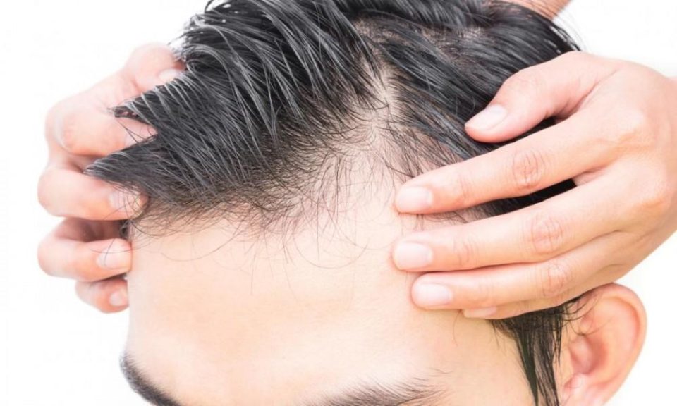 Combating Hair Loss - How A Hair Loss Clinic And Lifestyle Changes Can Help
