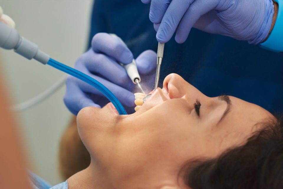 Dental Implants